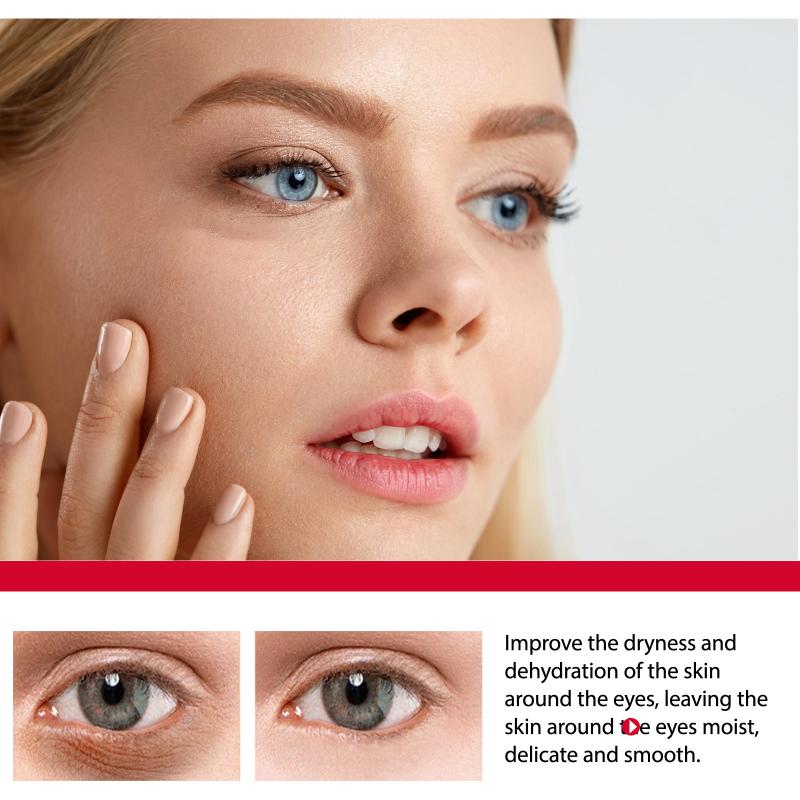 Women Bags Under Eyes - Anti-aging retinol oogcrème voor wallen en