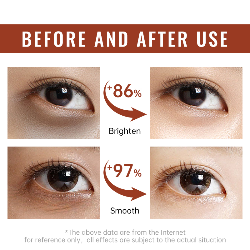 Retinol Verstevigende Oogcrème - Women Bags Under Eyes recensie en prijs